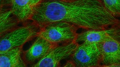 Células vistas al microscopio de fluorescencia, con el núcleo en azul, donde ocurre la autofagia